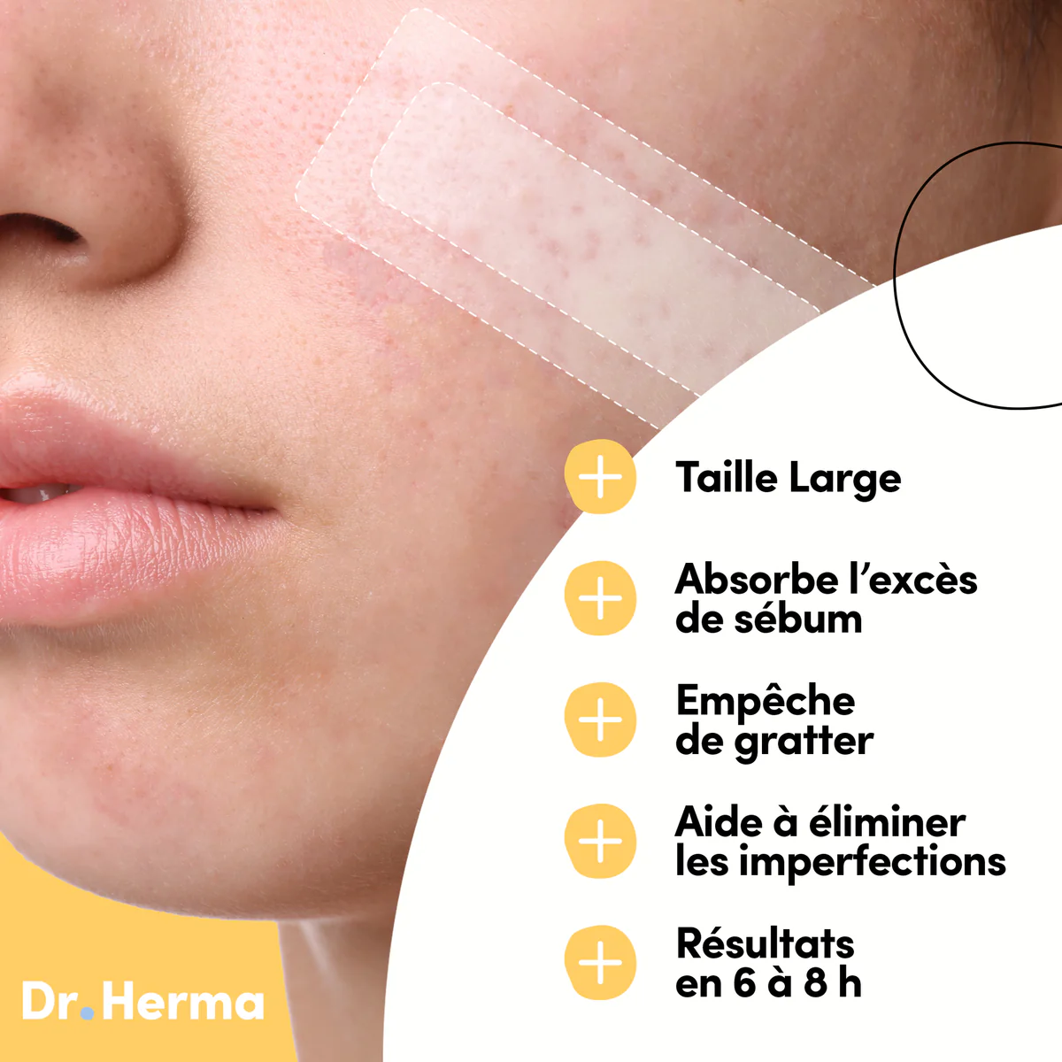 DR. HERMA Patchs Anti-Boutons Format Large – 10 patches