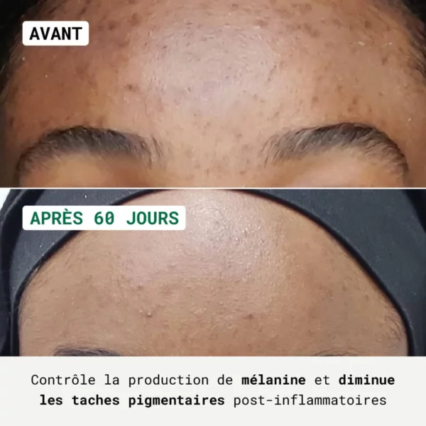 NUBIANCE Routine Anti-Taches – Visage