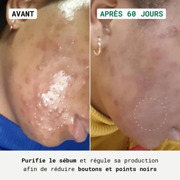 NUBIANCE Routine Anti-Imperfections – Visage