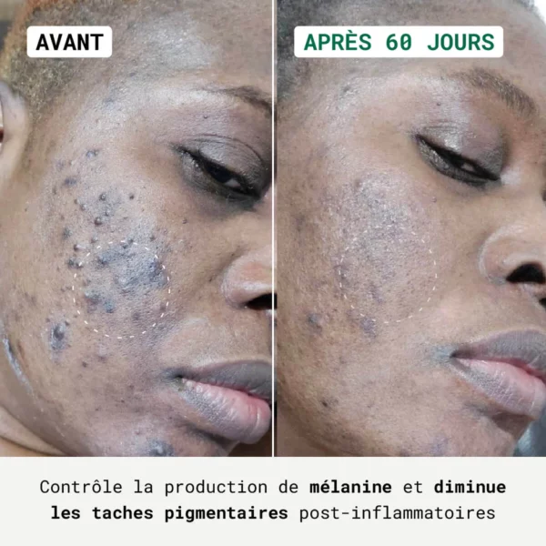 NUBIANCE Routine Anti-Taches – Visage et Corps