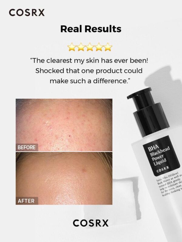 COSRX Exfoliant à l’Acide Salicylique BHA Points Noirs 100ml
