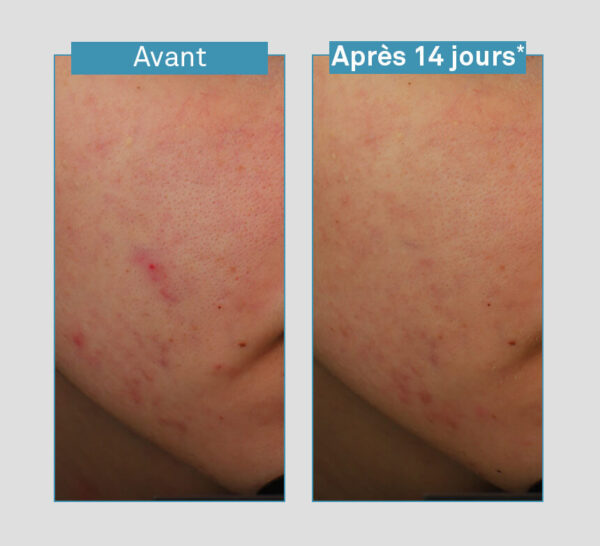LUXEOL Sérum Visage Anti-Imperfections 5en1