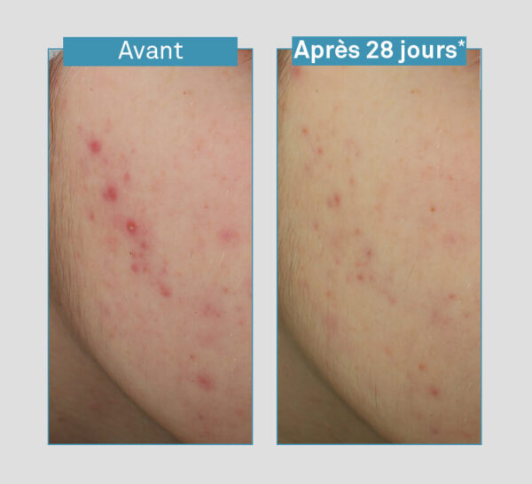 LUXEOL Sérum Visage Anti-Imperfections 5en1