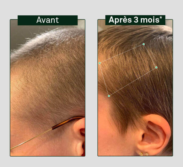 LUXEOL Routine Croissance