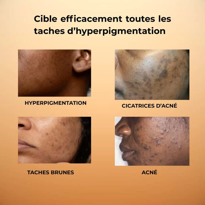 QOYA Routine Complète