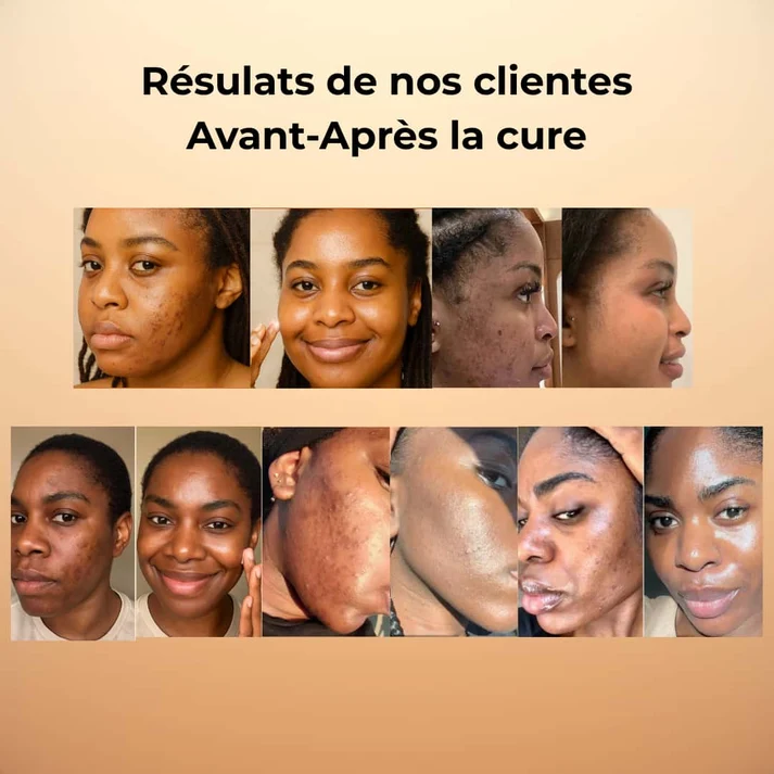 QOYA Routine Complète