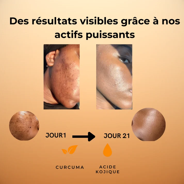 QOYA Routine Complète